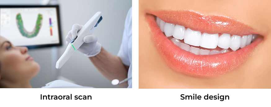 Si-Dent