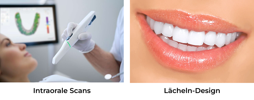 Si-Dent
